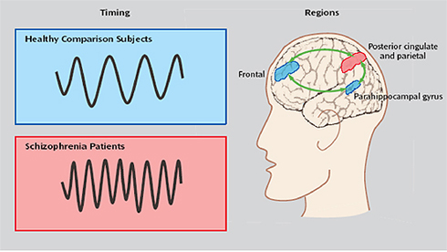 thebrain not syncing